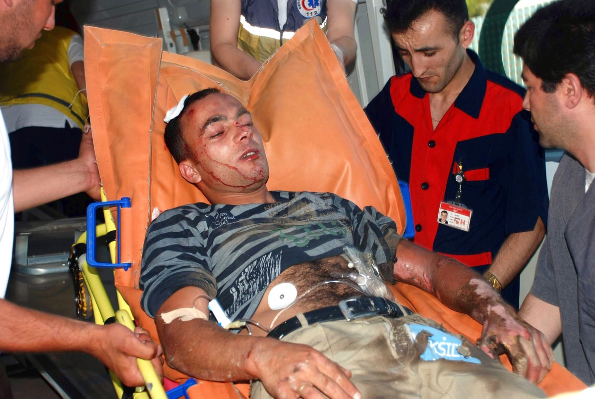 Elektrik Akımına Kapılan Genç Ağır Yaralandı