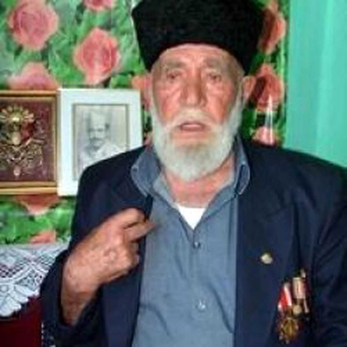 Göğsündeki Şarapneli 57 Yıldır Taşıyor