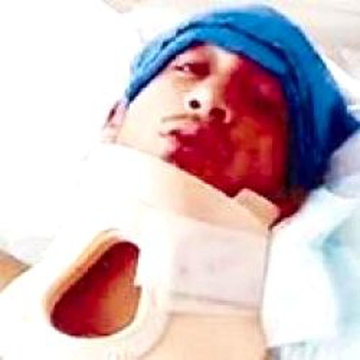 Hem Polis Kurşunuyla Felç Oldu Hem Hastanede Gözaltında
