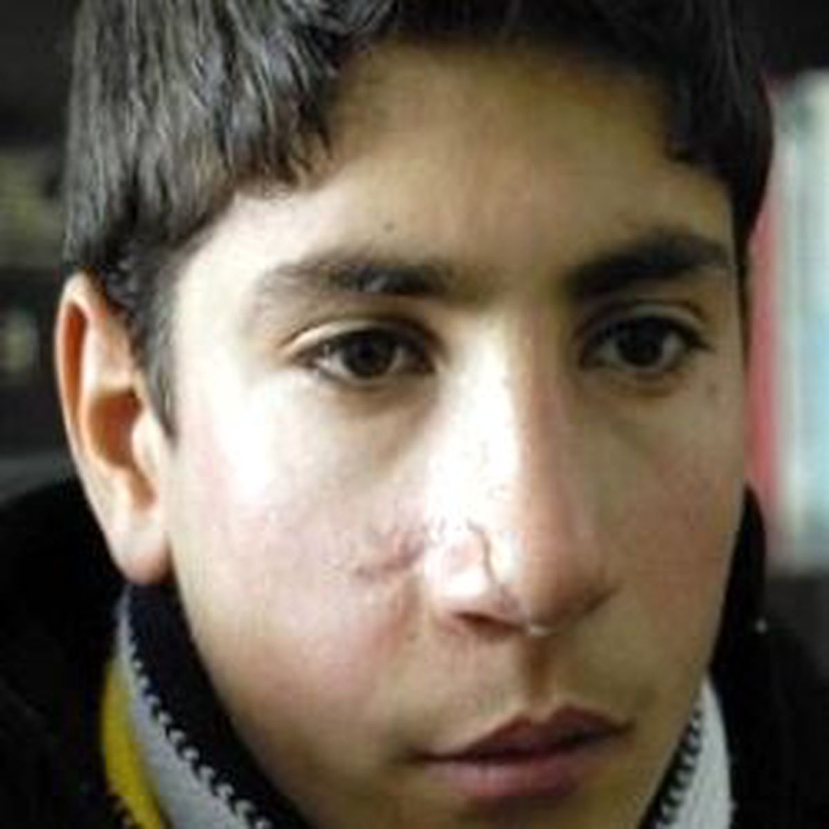 'Kazandığım Tazminatla Estetik Yaptıracağım'