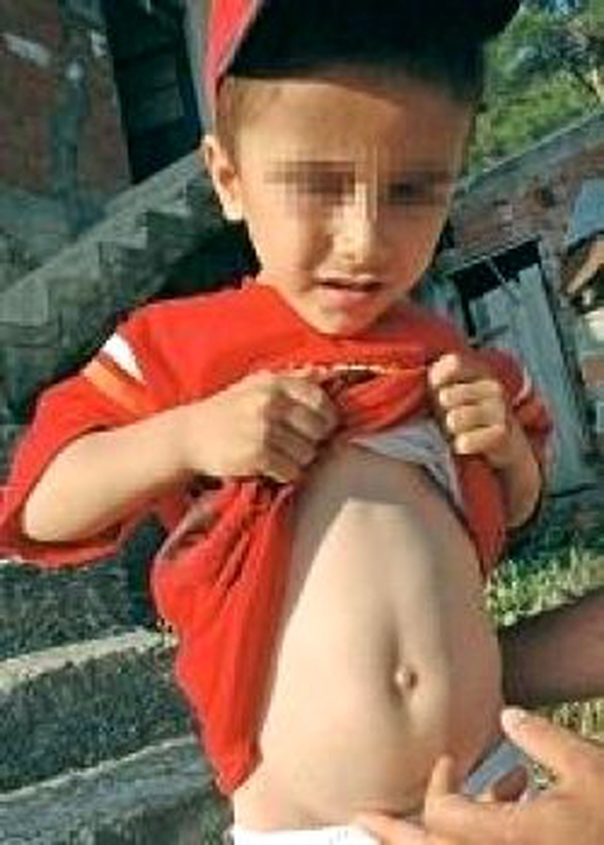 Çocuğunu Kene Isıran Baba Kalp Krizi Geçirdi