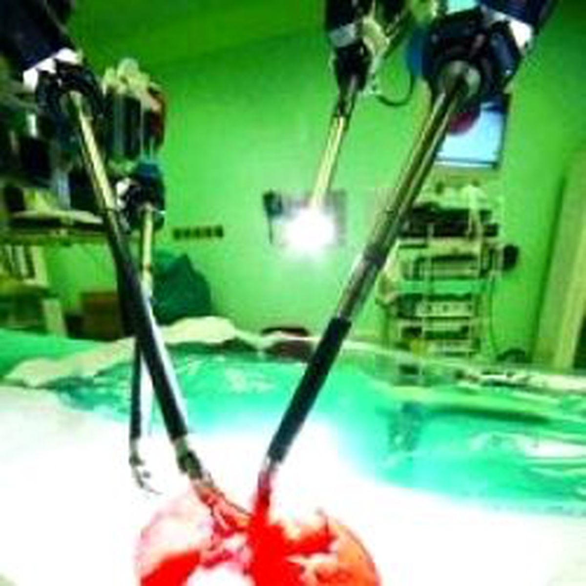 Robotik Cerraha Domatesli Tanıtım