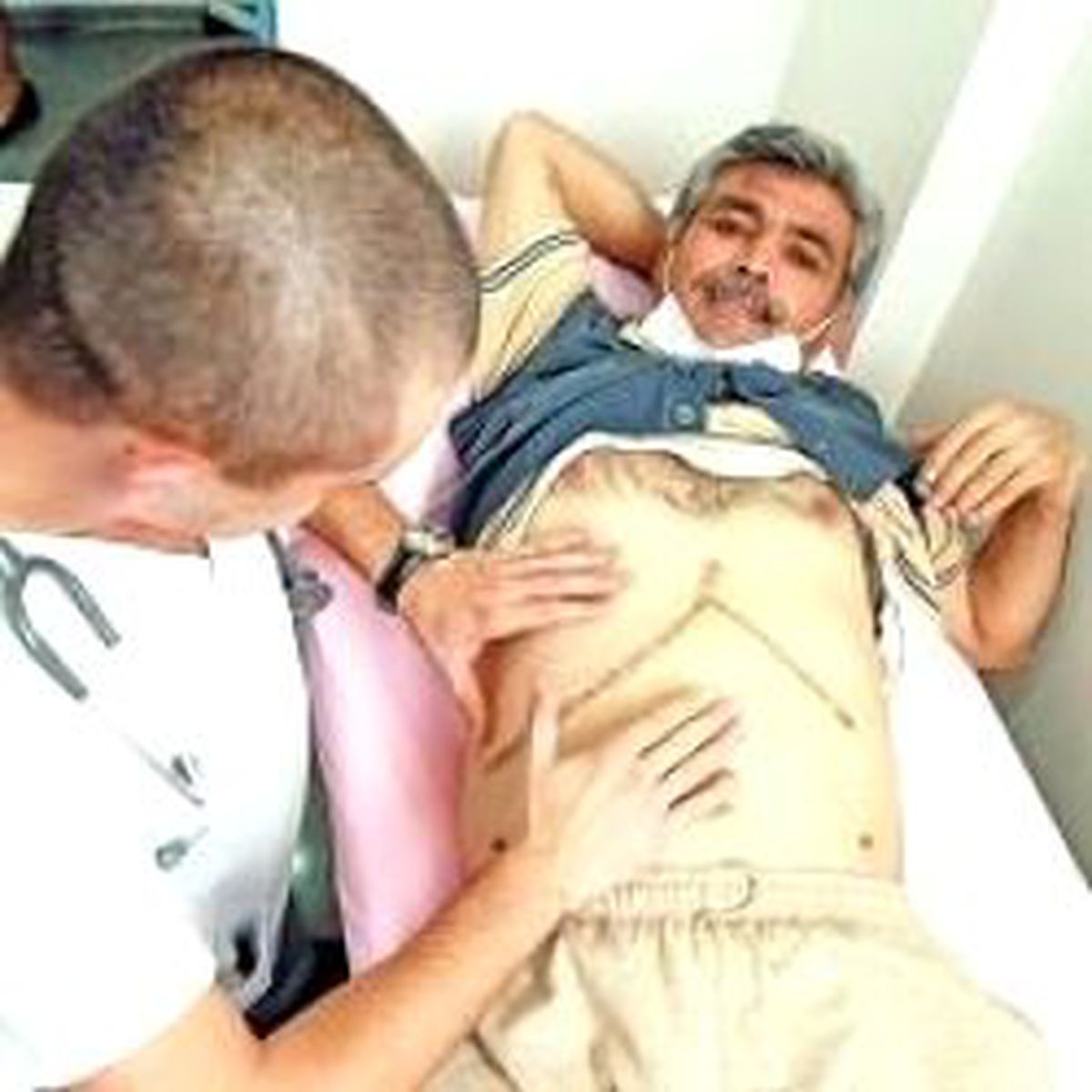 Karaciğer Hastaya Tersinden Yerleştirildi