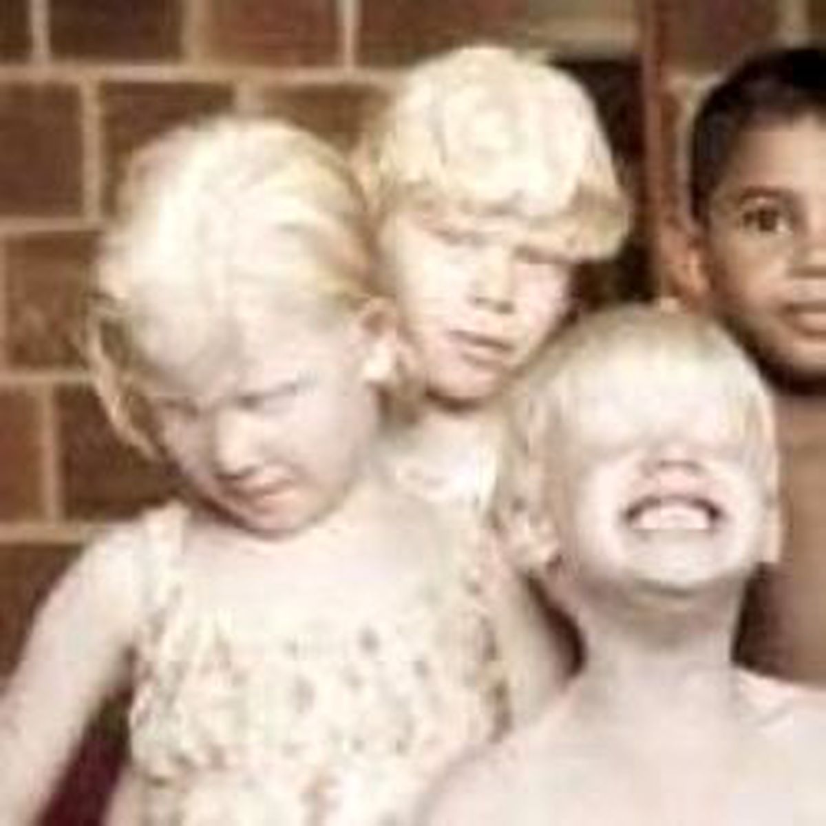 Ender Görülen Albino Olayı