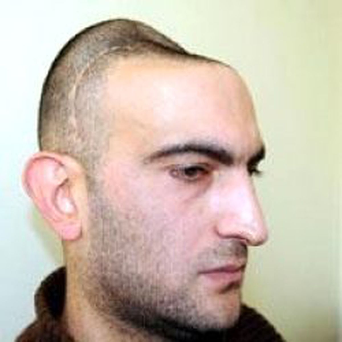 Sağlam Raporu Verdiler