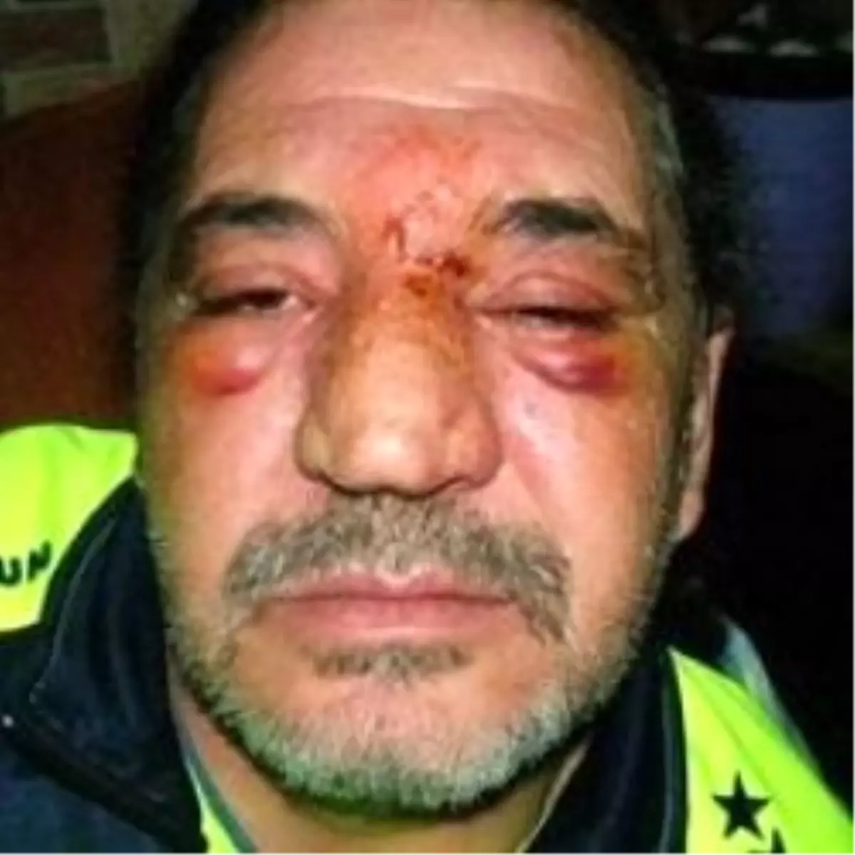 Kamyon Değil Tabela Çarptı