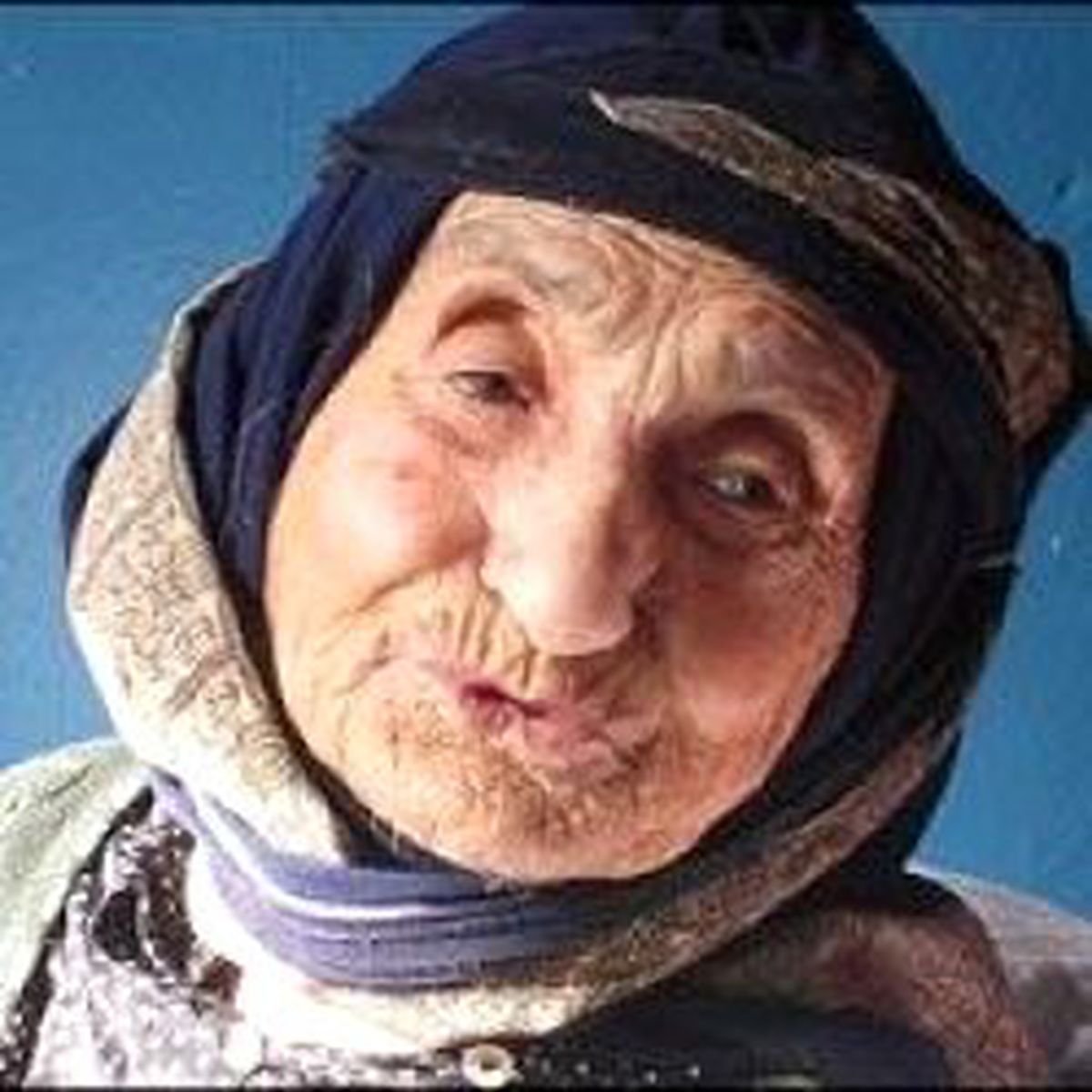Artık Onlar da Erken Ölüyor