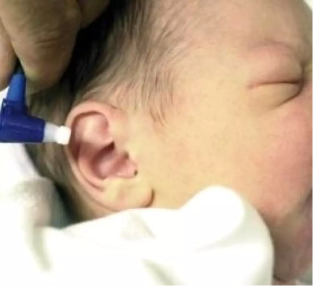 4 Bin Bebek İşitme Engelli Doğuyor