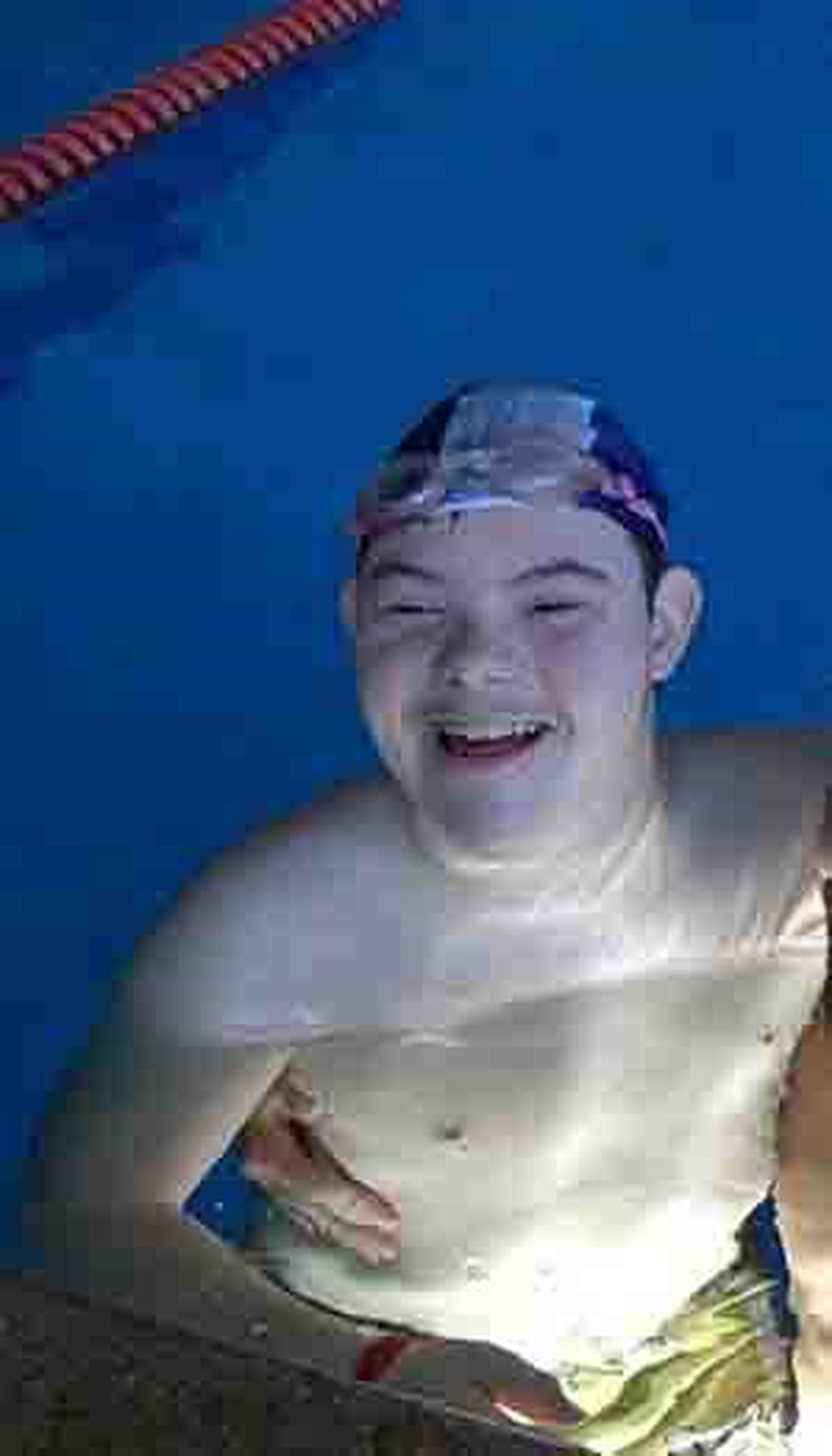 21 Mart Dünya Down Sendromu Günü artık ülkemizde de kutlanıyor.