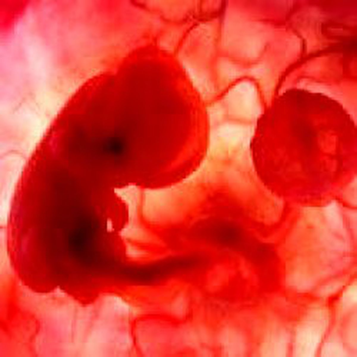 'Spermlerimi Çaldın' Kavgası