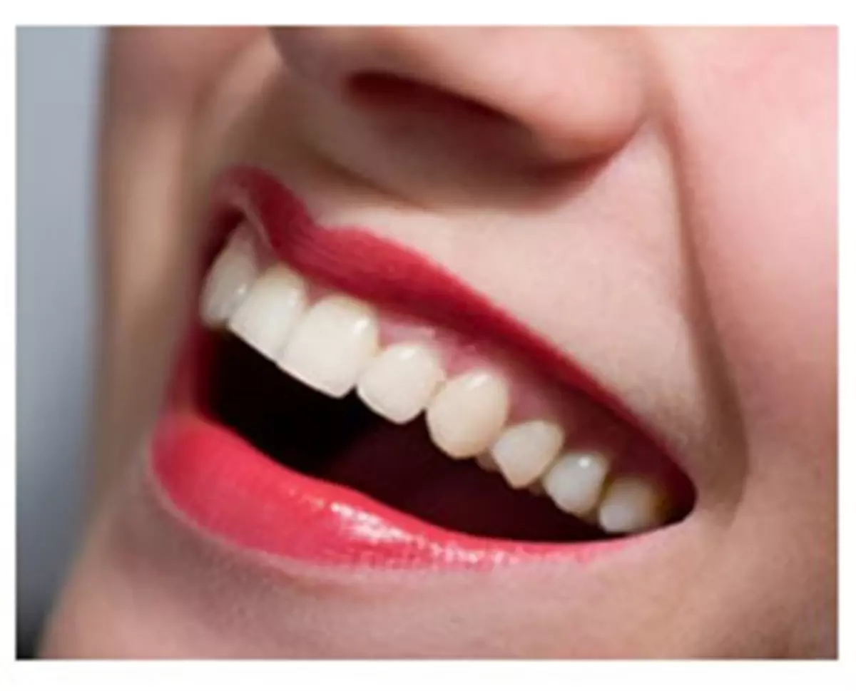 Dişlerinizdeki Bozukluk Yüz İfadenizi Etkiliyor