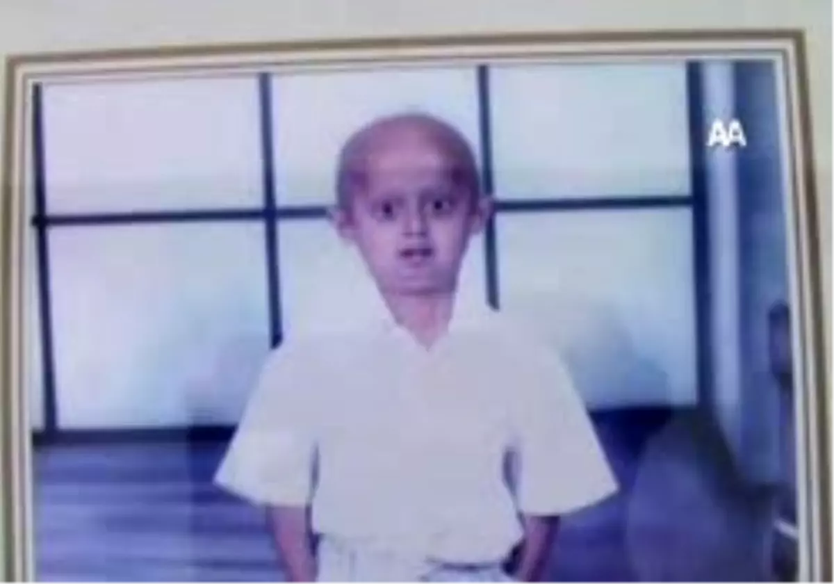 12\'sinde Yaşlılıktan Öldü