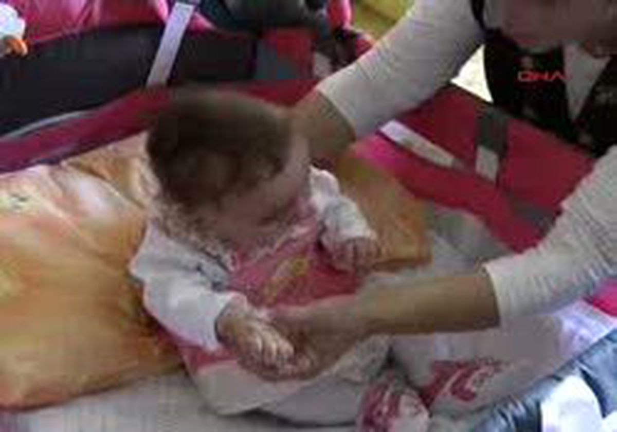 Tekirdağ - Doğum Sırasında Sinirleri Zedelenen Bebek Felç Oldu