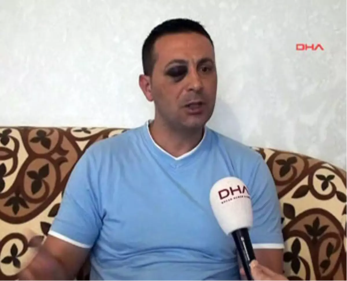 Alman Polisi Şiddette Sınır Tanımadı