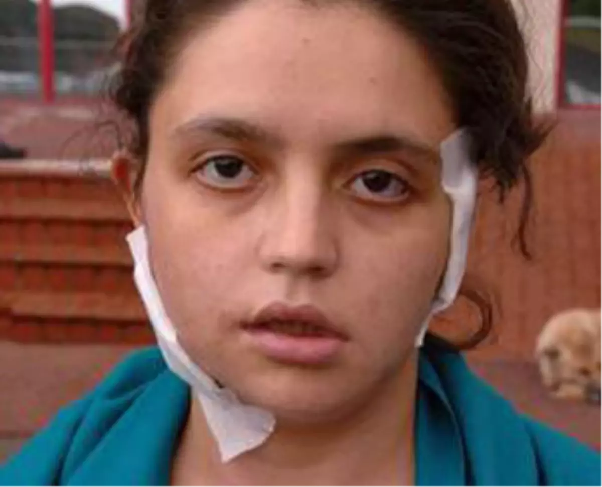 Özlem Öğretmen Yaşam Mücadelesini Kazandı