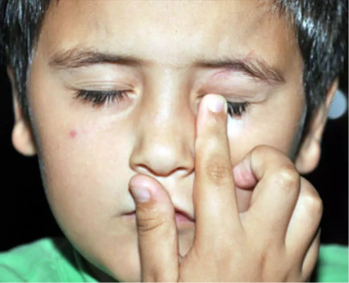 Ailenin \'Pitbul\'lu Dehşet Gecesi