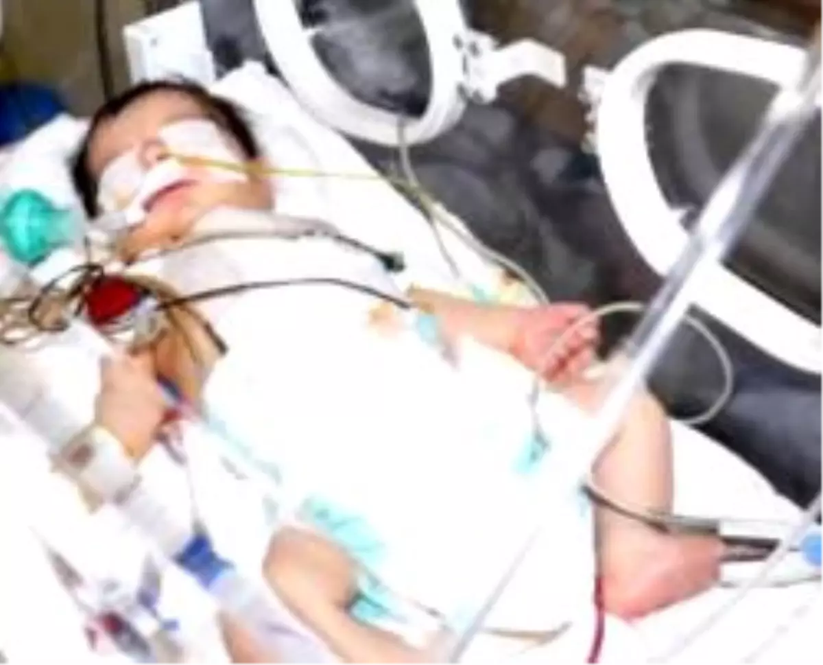 4 Saatlik Operasyonla Hayata Tutundu