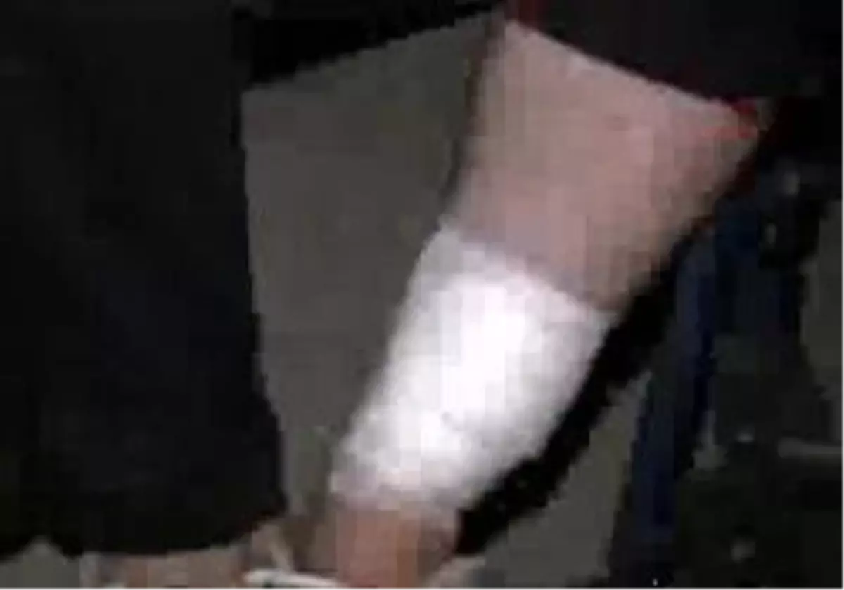 Eskişehir - Eskişehir\'de Pitbull Dehşeti: 2?Si Çocuk 3 Yaralı