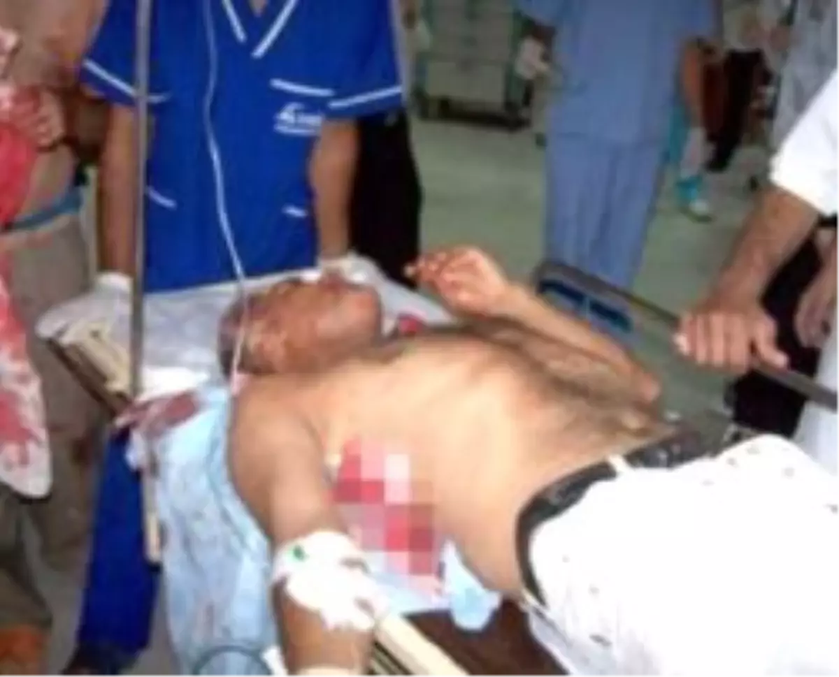 Polis Kurşunu ile Vuruldu İddiası