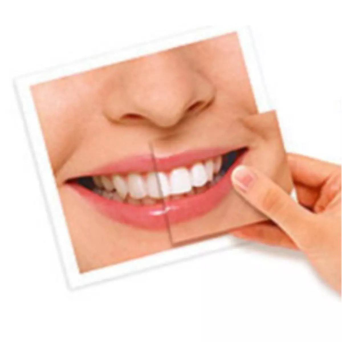 Diş Beyazlatmada Son Trendler