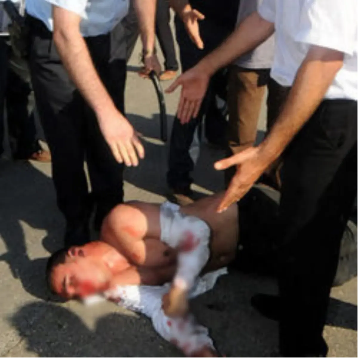 Birdal\'a saldıran Genc Yoğun Bakımda