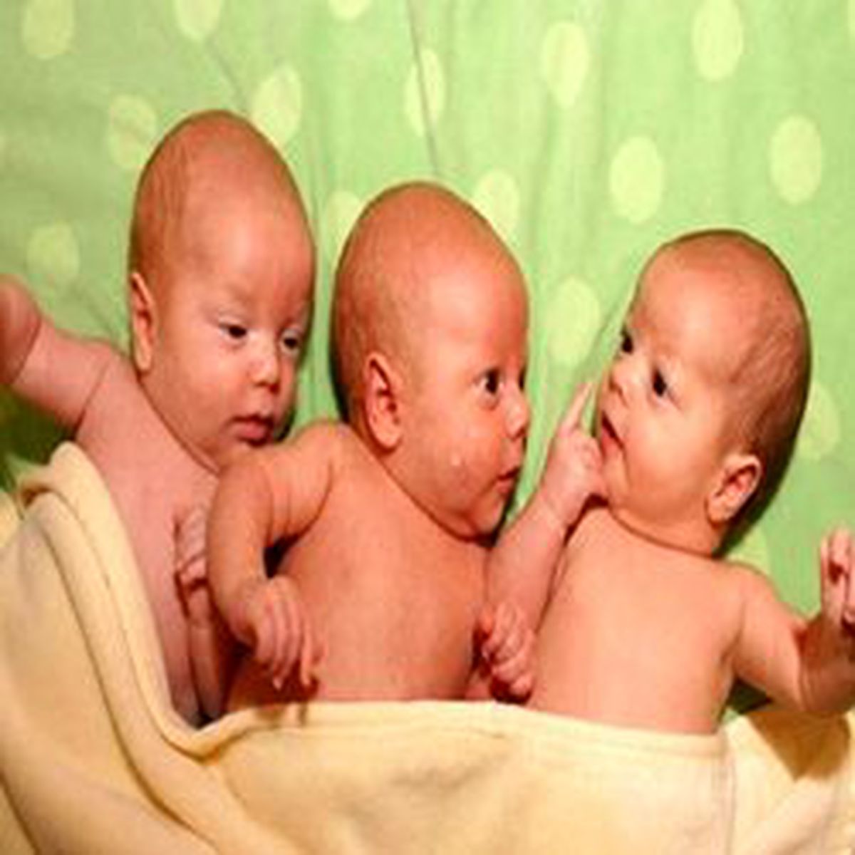 On Milyonda Bir İhtimalle Üçüz Bebek Sahibi Oldular