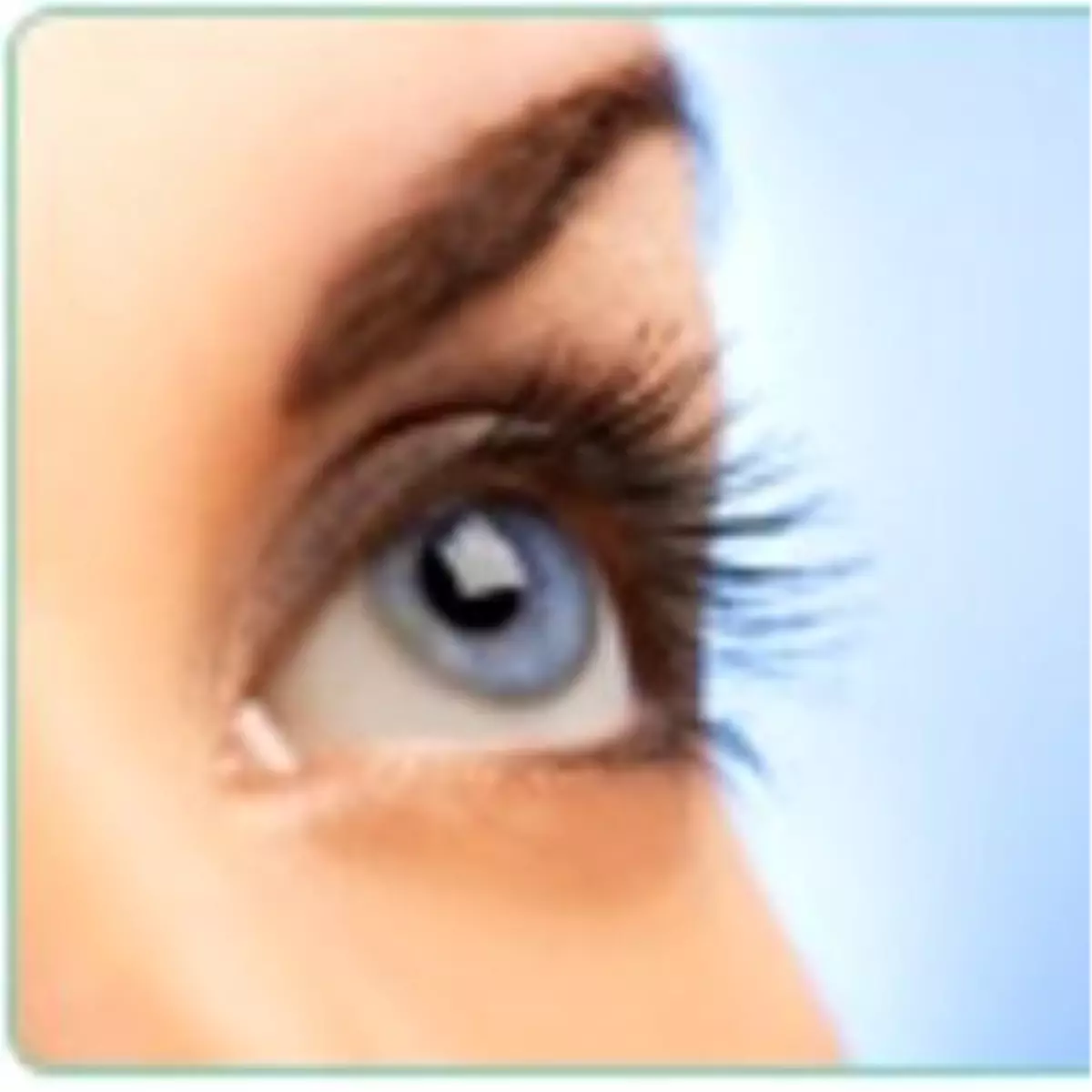 Keratokonus Nedir, Nasıl Tedavi Edilir?