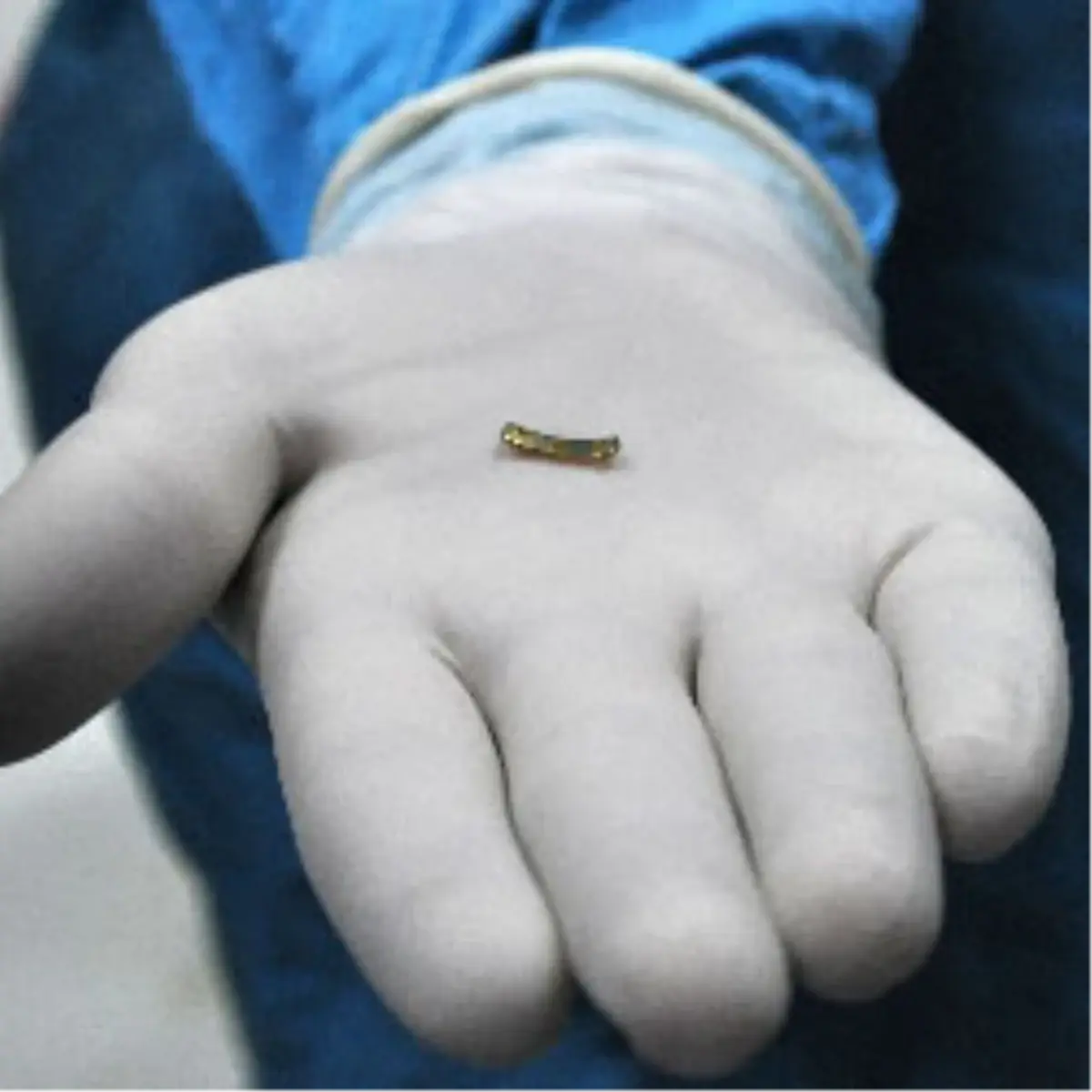 Göz Kapağında 24 Ayar Altın