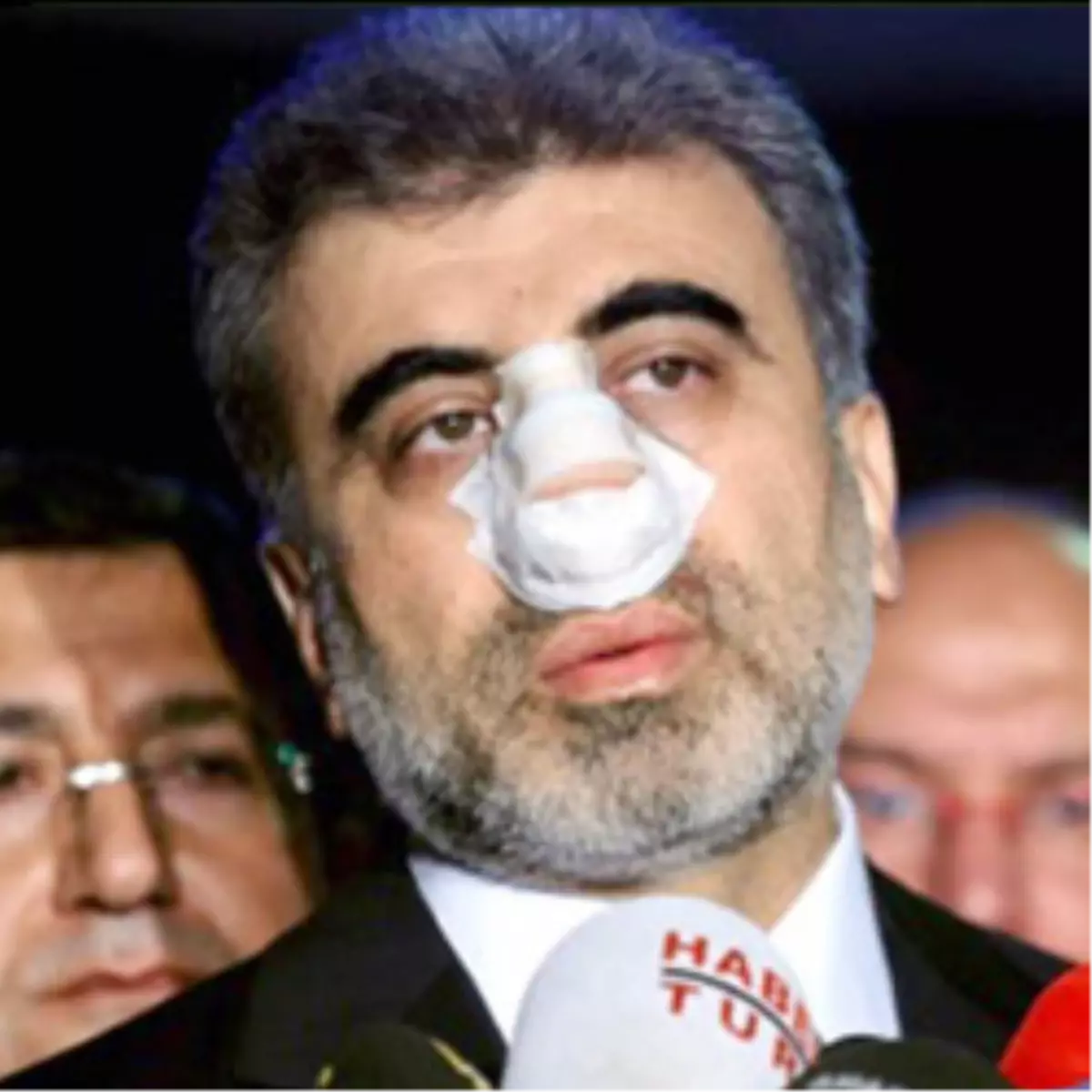 Bakan Yıldız'a Yumrukta Karar