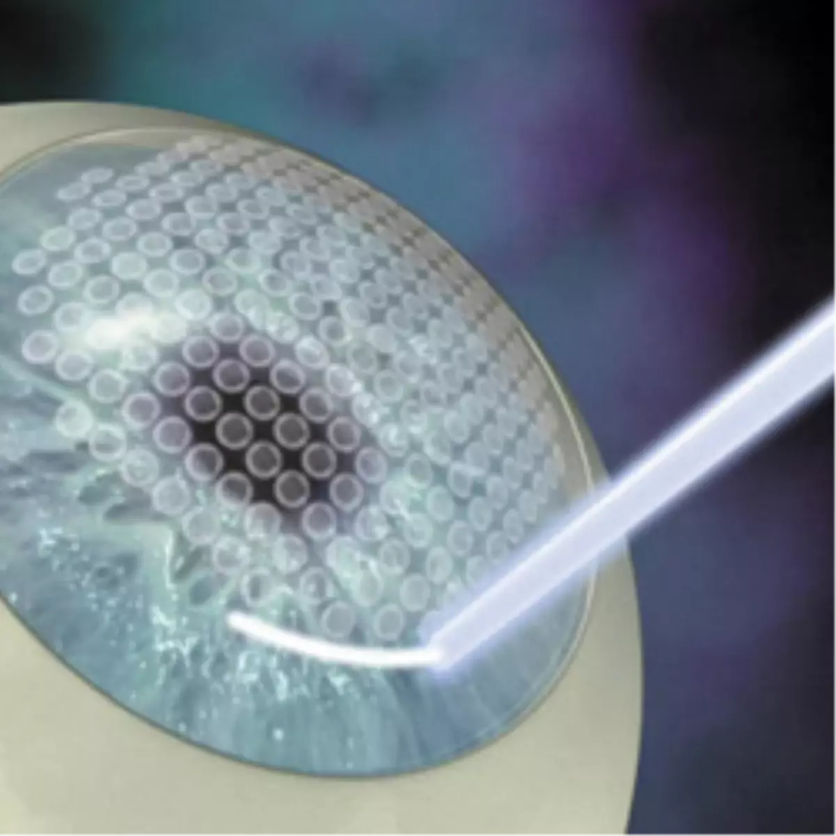 İ-Lasık Teknolojisi Dünyagöz\'de!