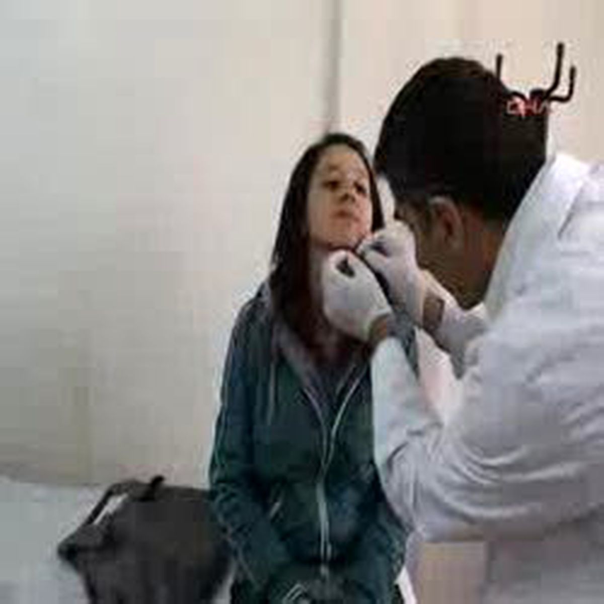 Sivas - Çenesinin Altındaki Taş 12 Yıl Sonra Çıkarıldı