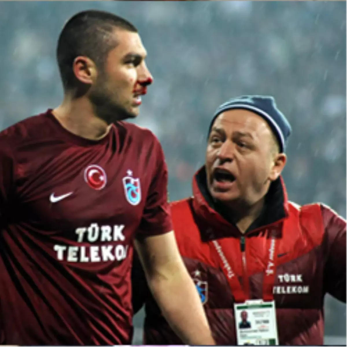 Burnu Kırılan Burak Oyundan Çıkmak İstemedi