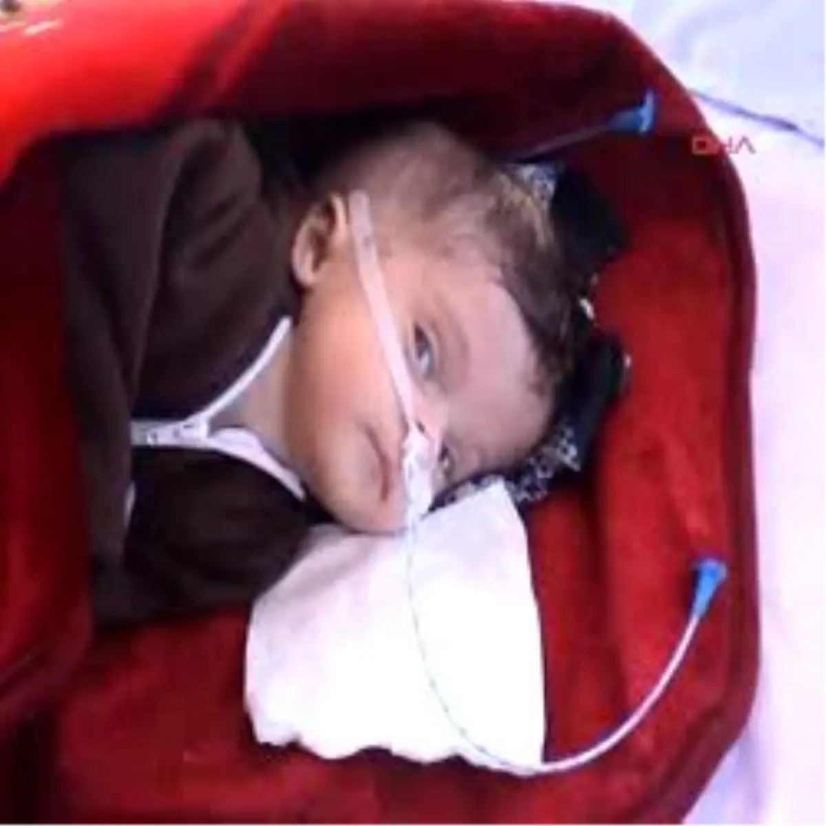 Bulut Ailesinin Yaşamı Yürek Burkuyor