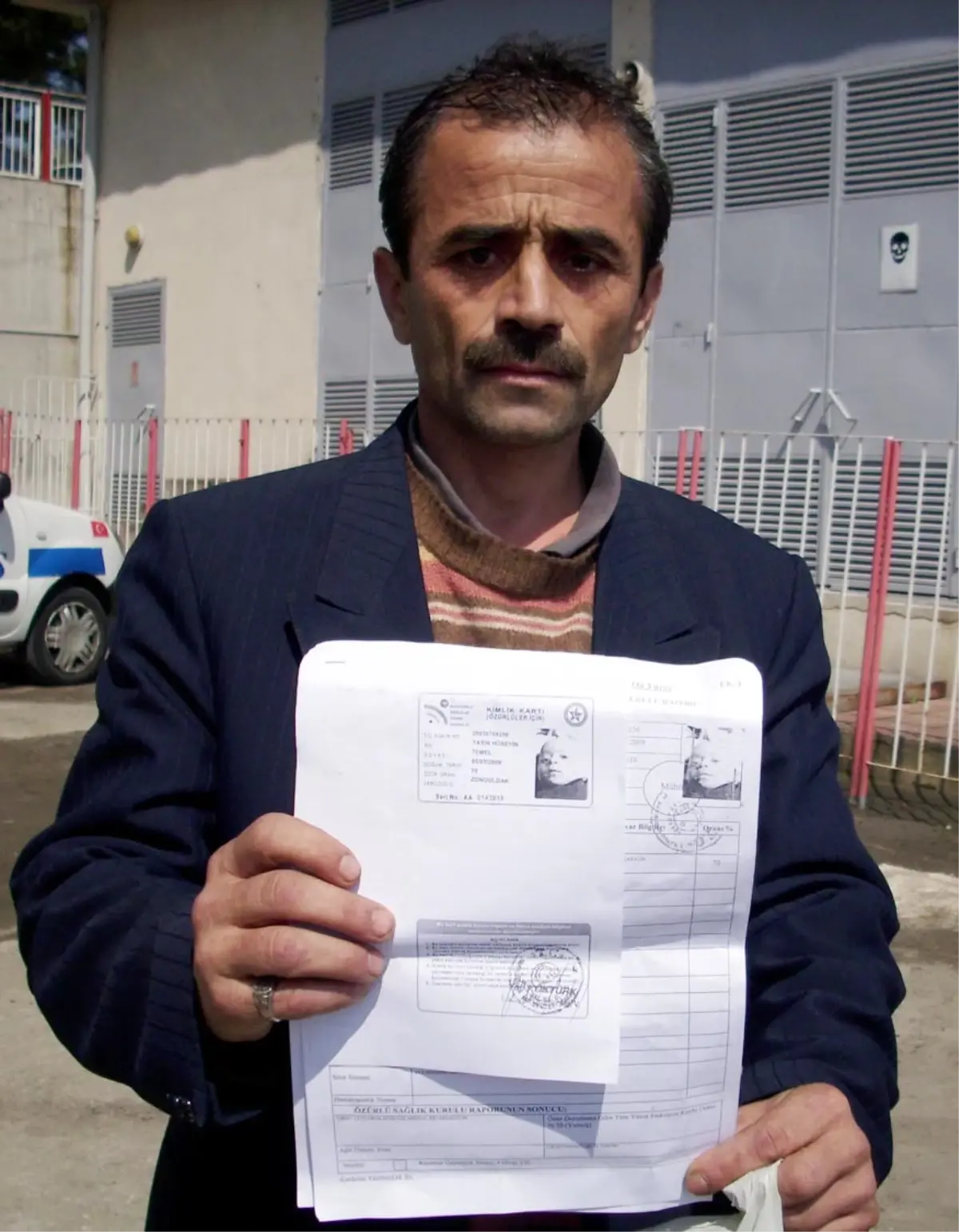 Hastaneye, Down Sendromlu Çocuğu Yaktığı İddiasıyla Suç Duyurusu