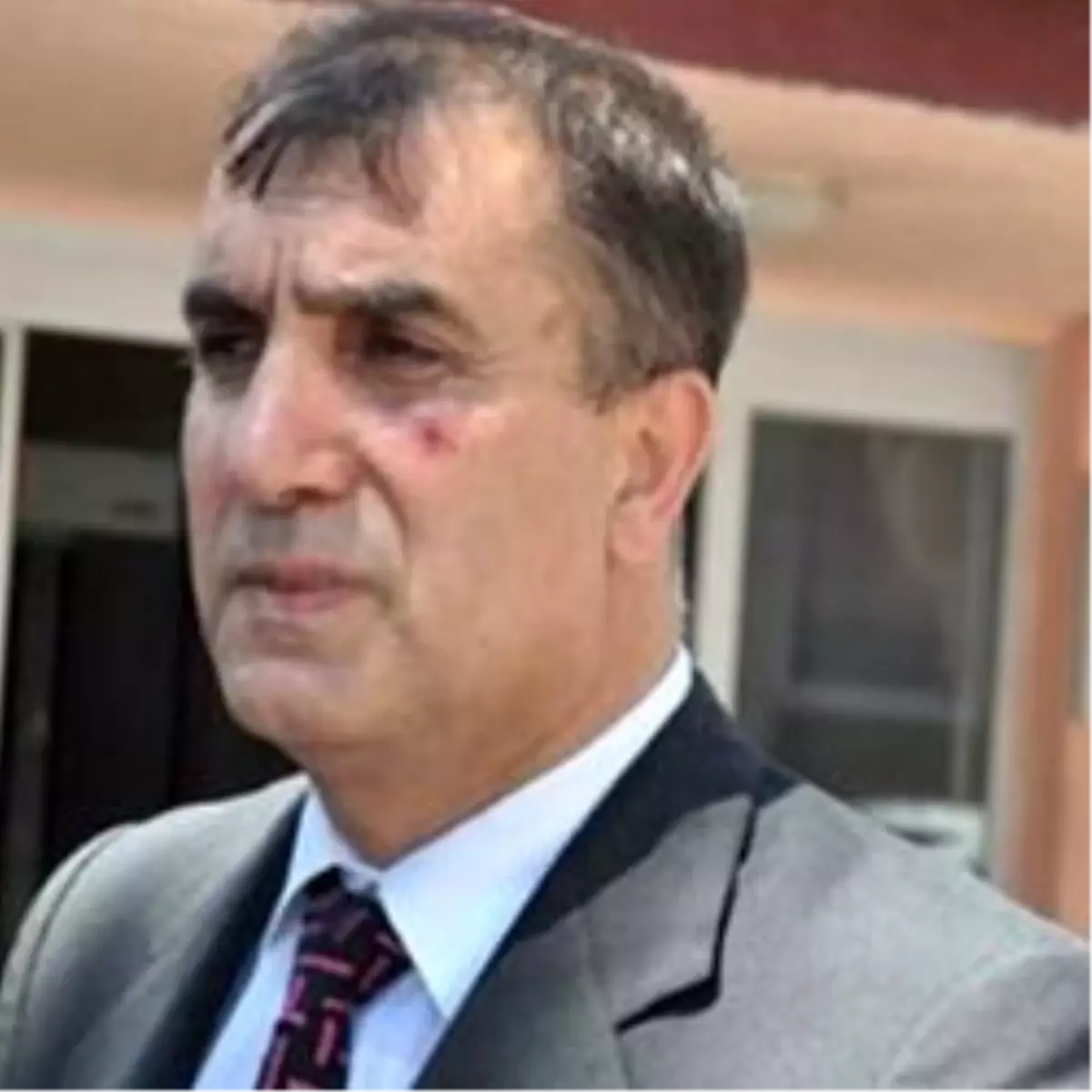 Vali Yardımcısı Basın Müdürüne Kafa Attı