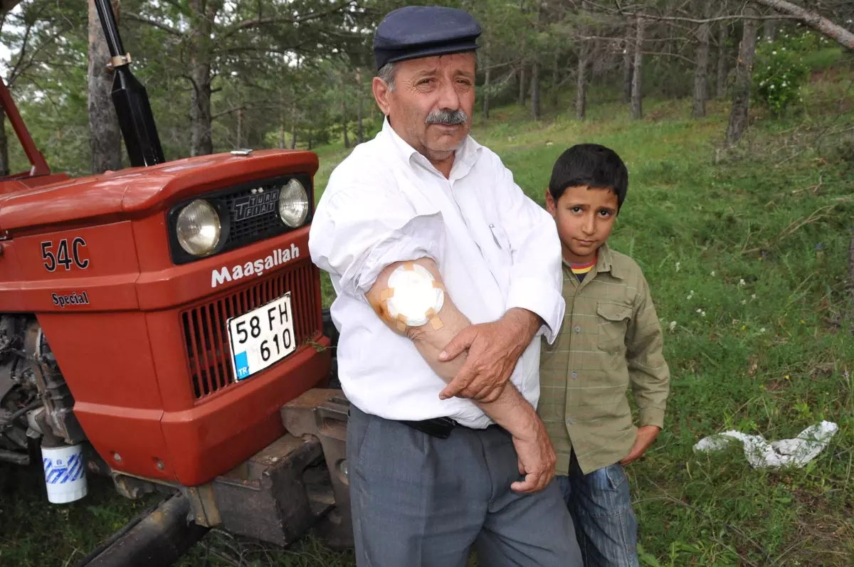 Kolunda Unutulan Sargı Beziyle 15 Yıl Yaşadı