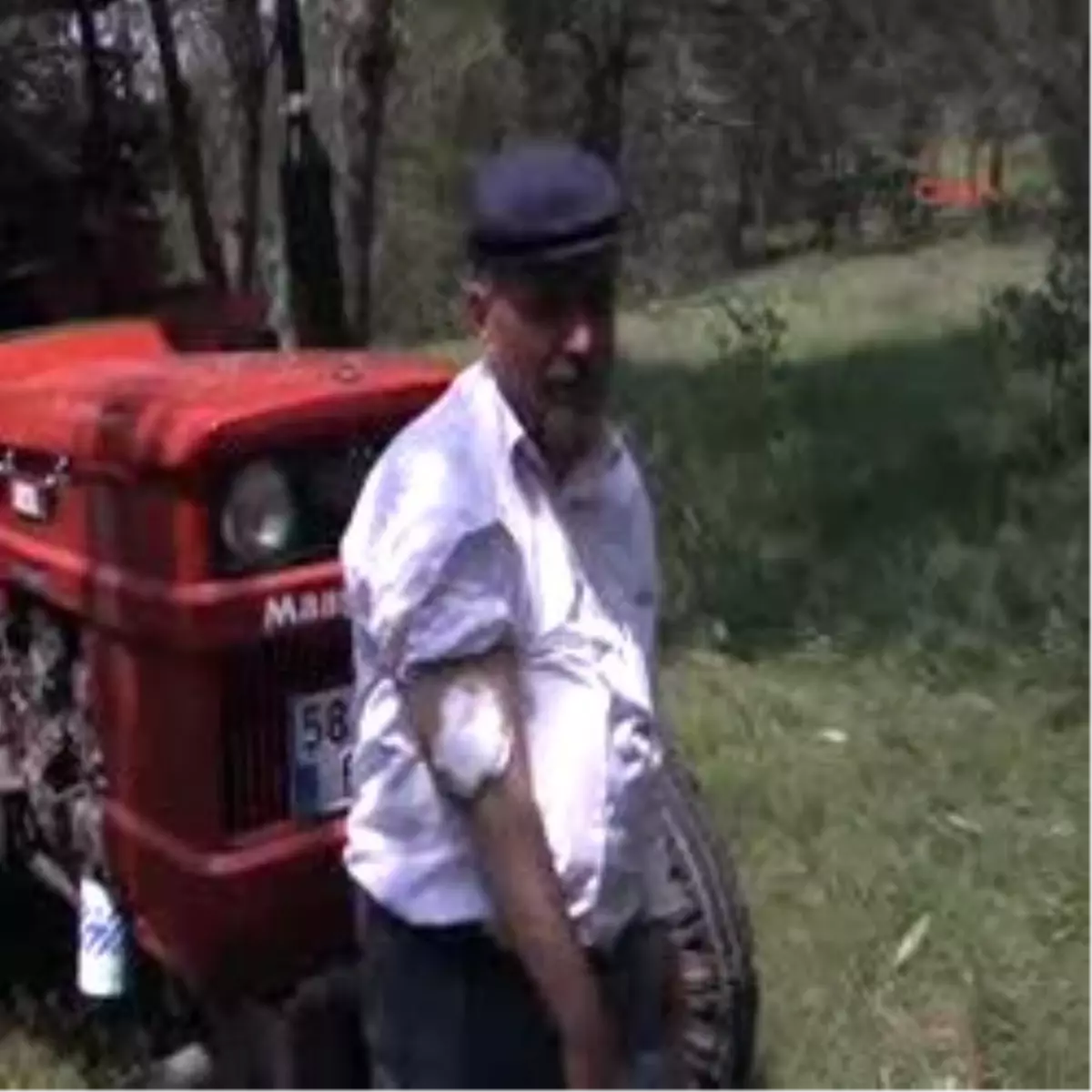 Kolunda Unutulan Sargı Beziyle 15 Yıl Yaşadı