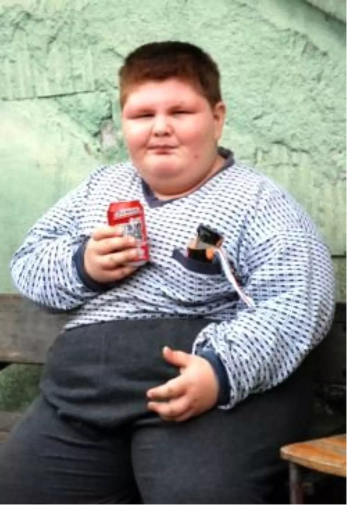 9 Yaşındaki Obezite Hastası Çocuk Öldü