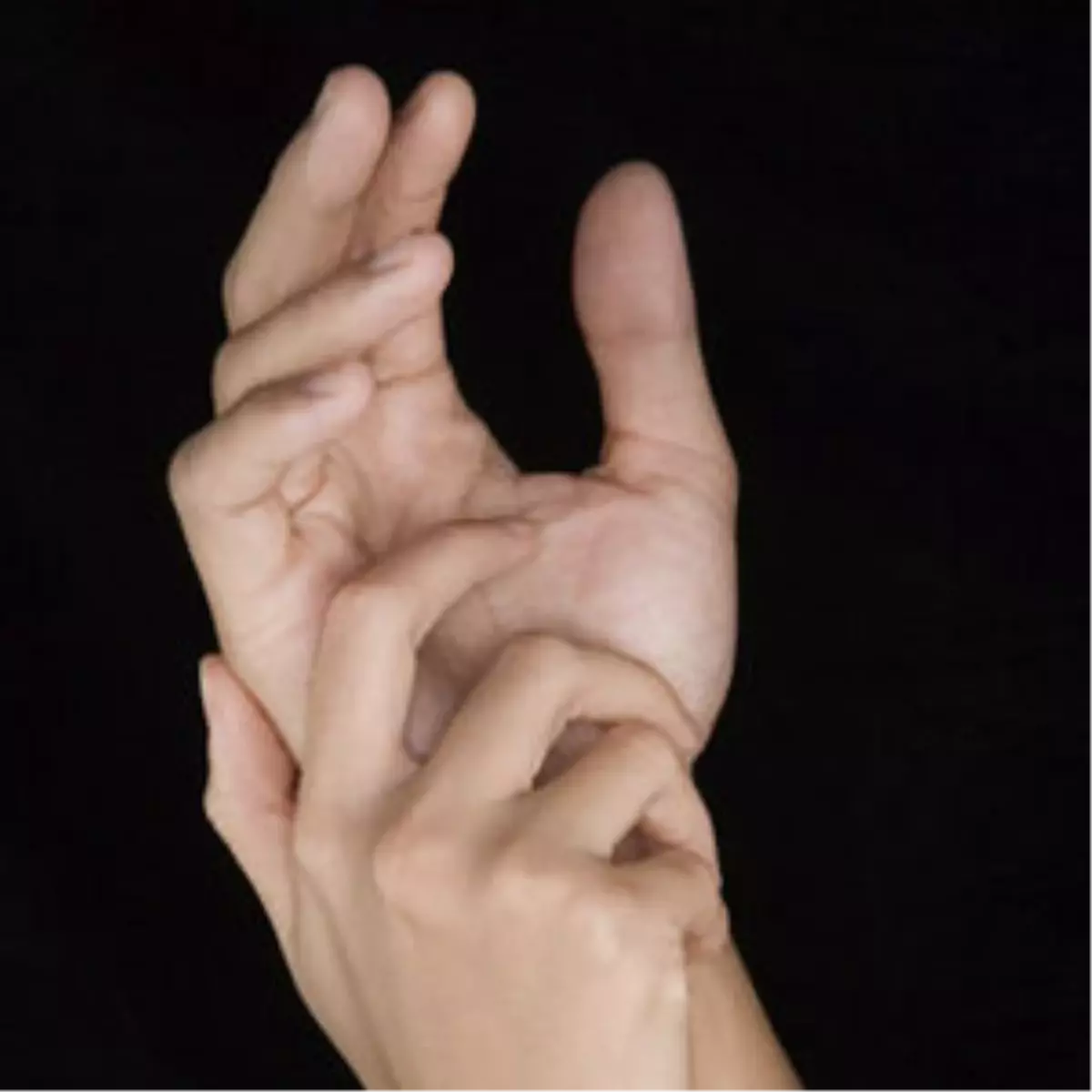 Elleriniz Uyuşuyorsa Dikkatli Olun!