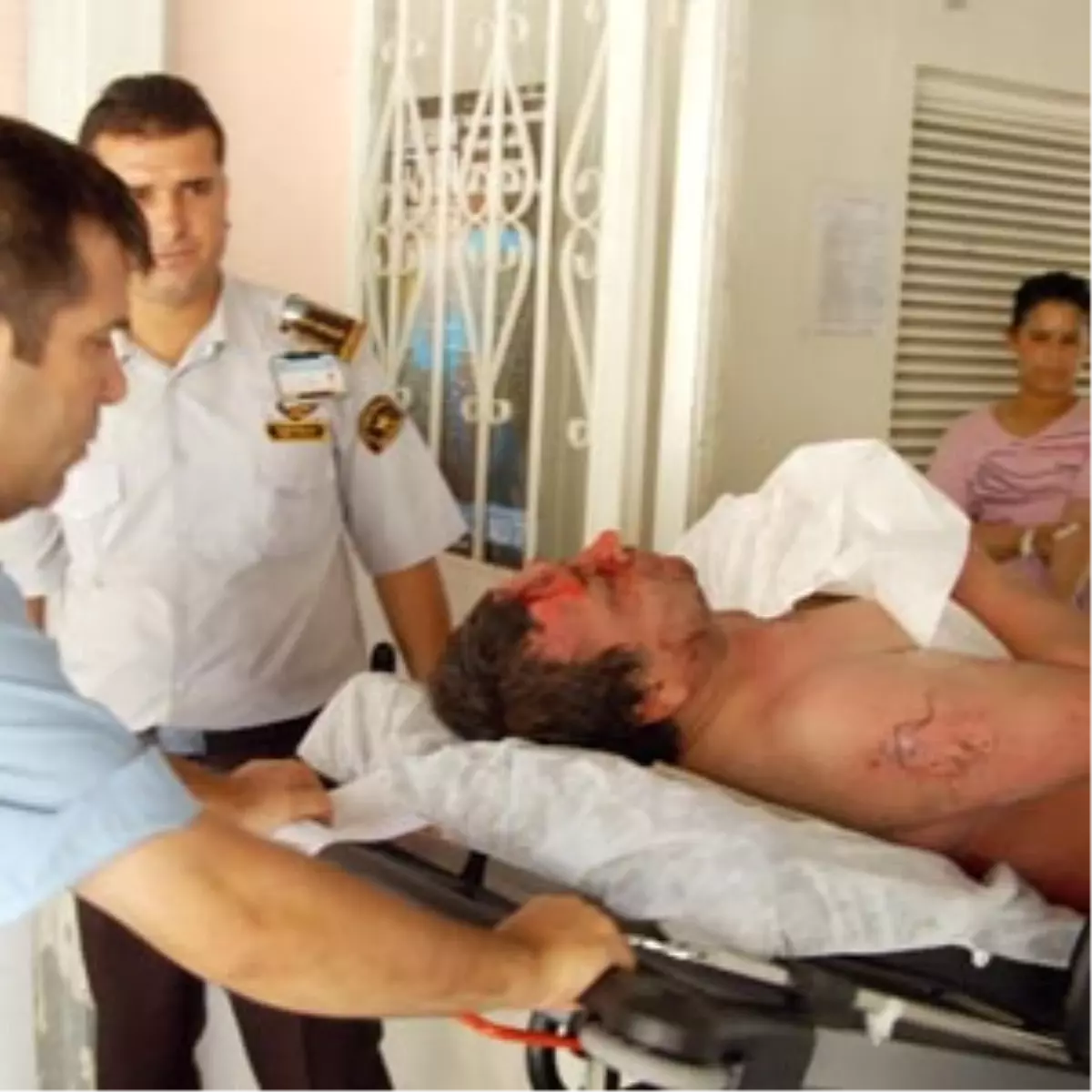 Sigara Yakayım Derken Kendini Yaktı