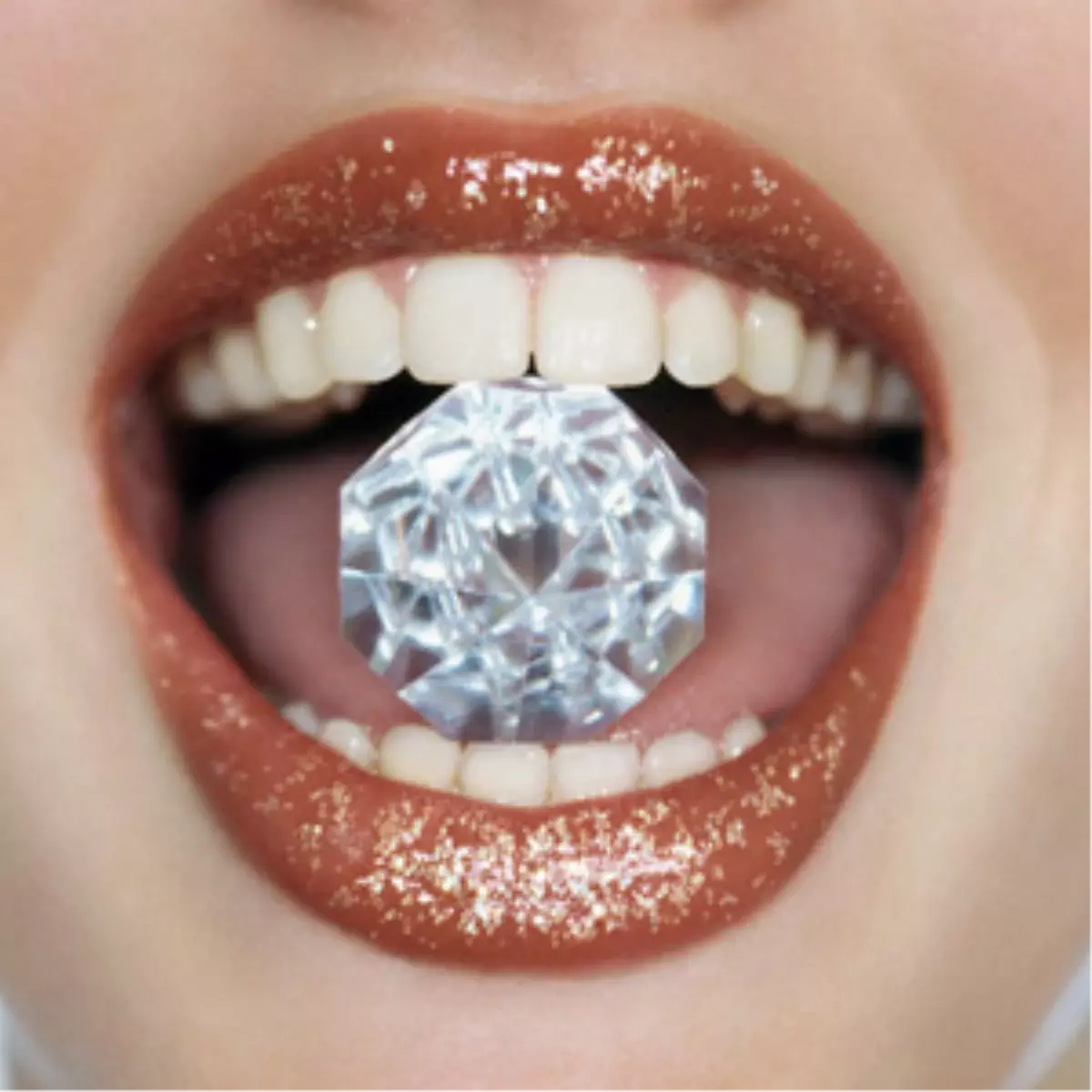 Diş Estetiğinde En Popüler İşlemler