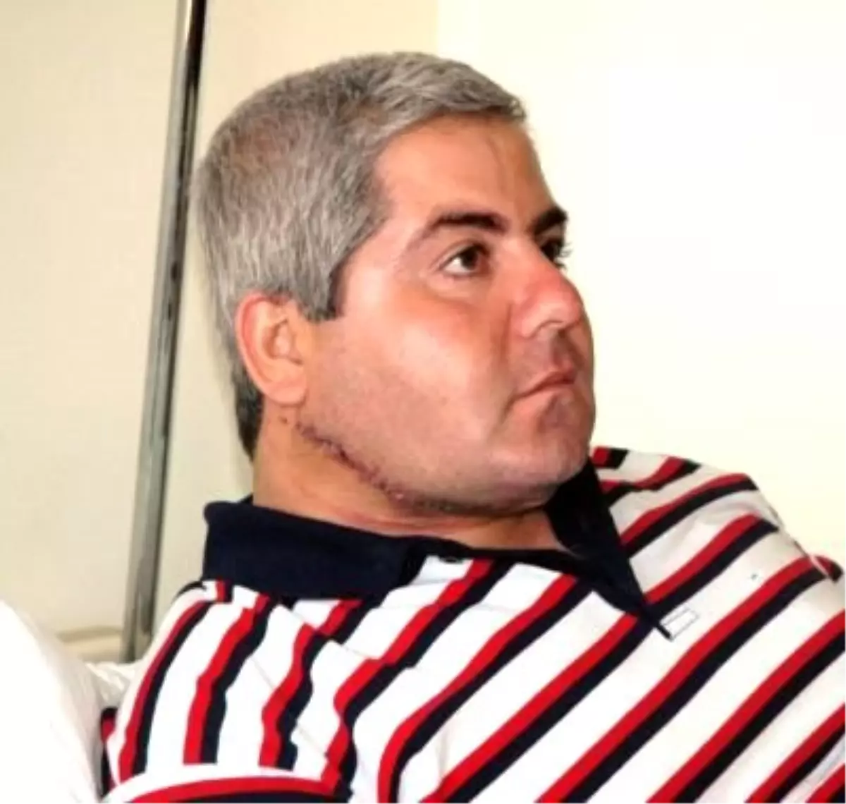 Gaziye Leğen Kemiğinden Çene