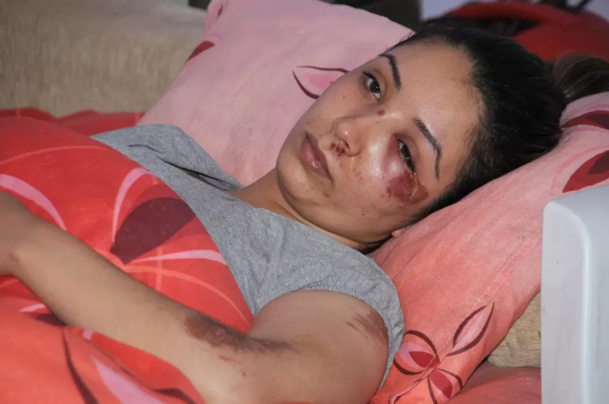 Koca Dayağı Mağduru Kadın Devletten Koruma Bekliyor