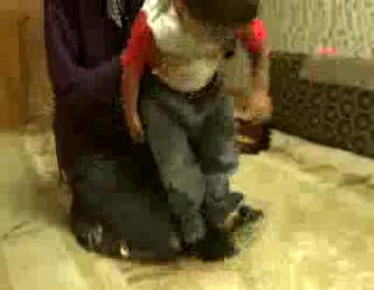 Biyonik Kulaklığı Çalınan Haşim, 15 Bin TL'lik Senetle Kulaklığına Kavuştu