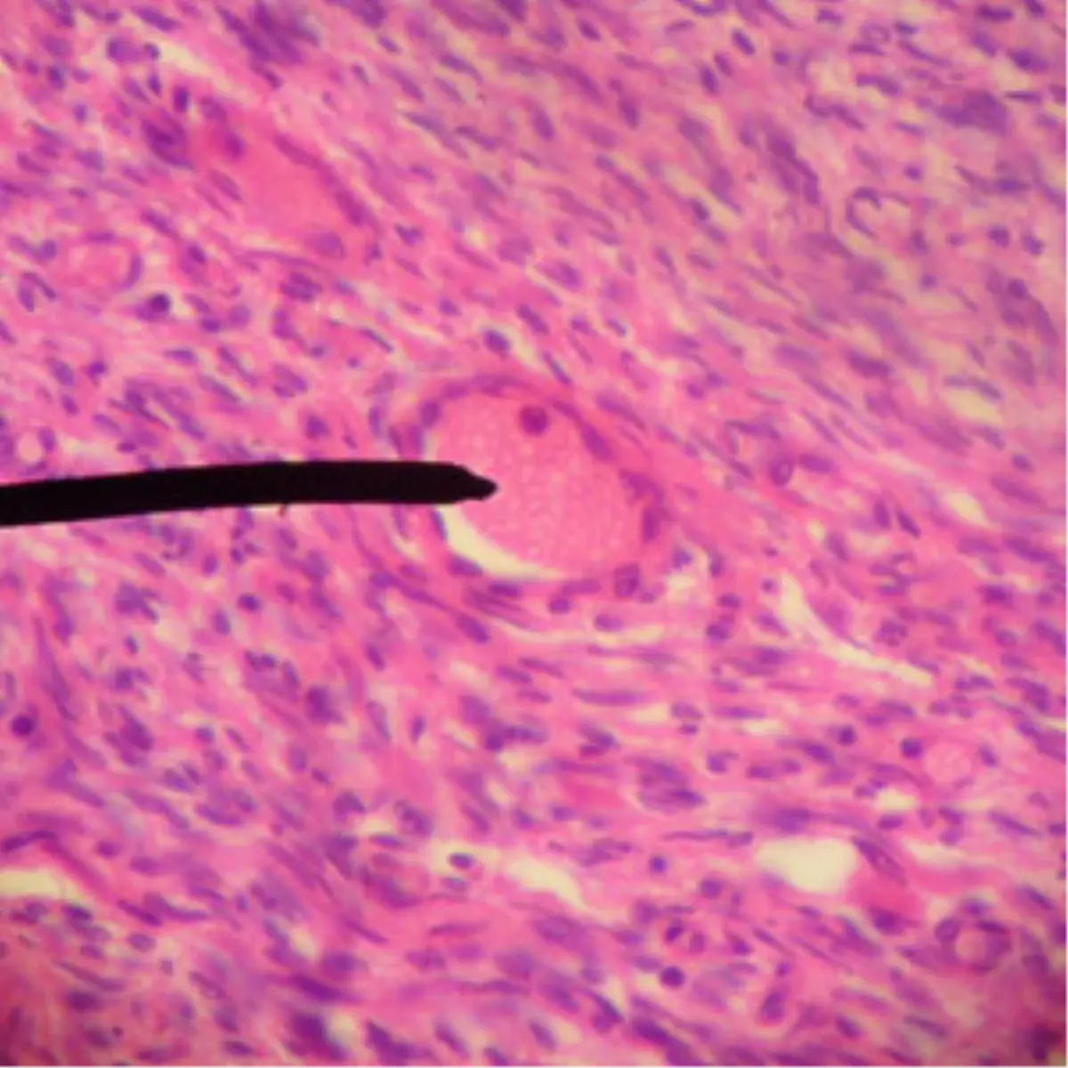 Saç Faili Meçhulleri Çözecek