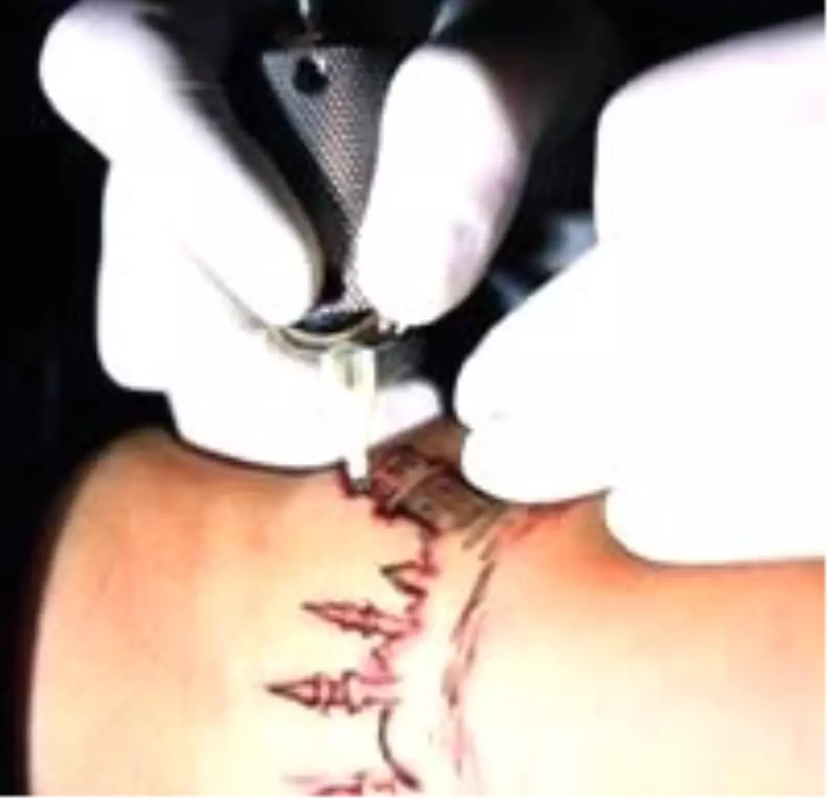 Dövme Hakkında Acı Gerçekler