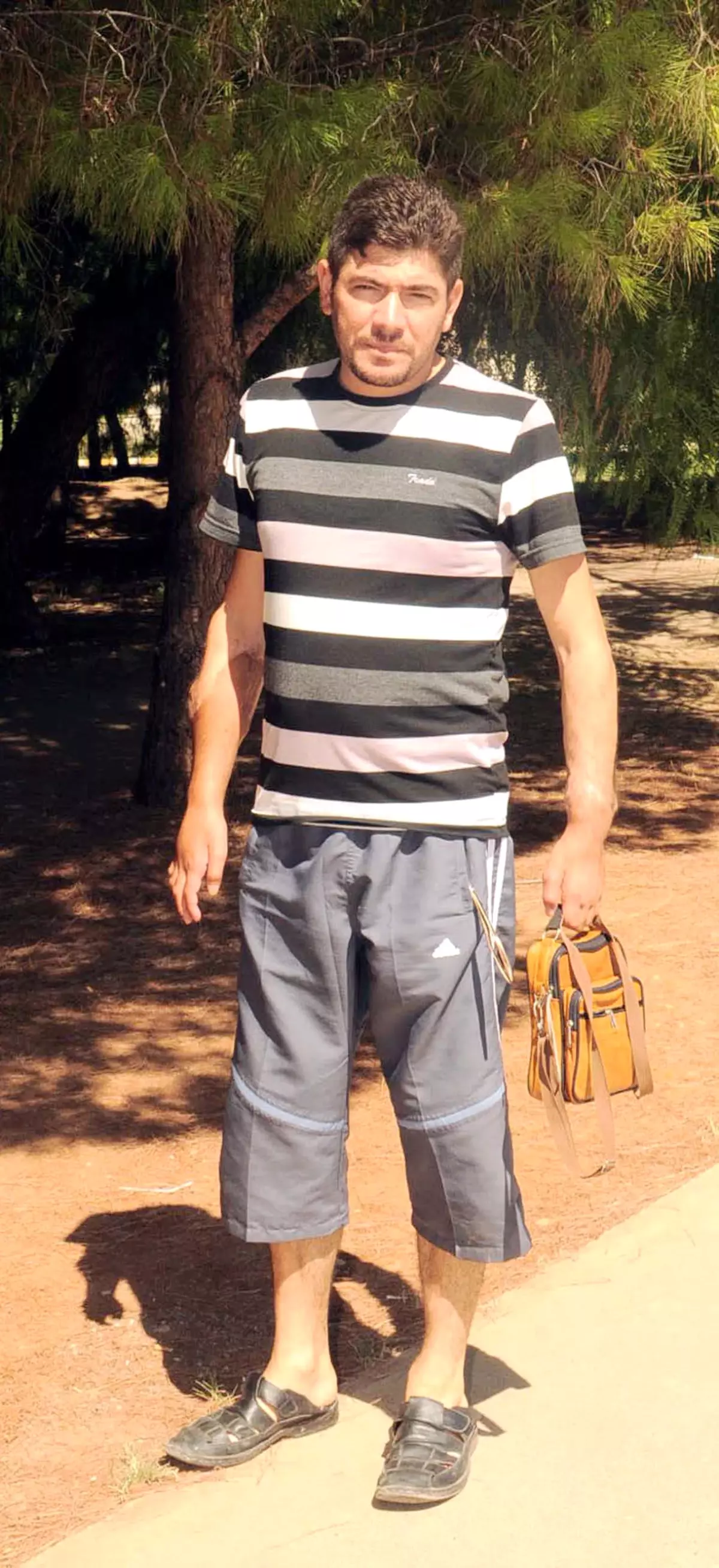 Geçen Yıl Kol Nakledildi, Bilek Güreşi Bile Yapıyor