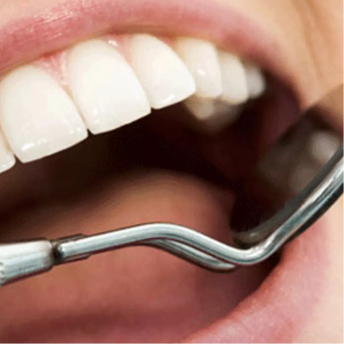 Ağız ve Diş Bakımında Doğru Bildiğimiz Yanlışlar