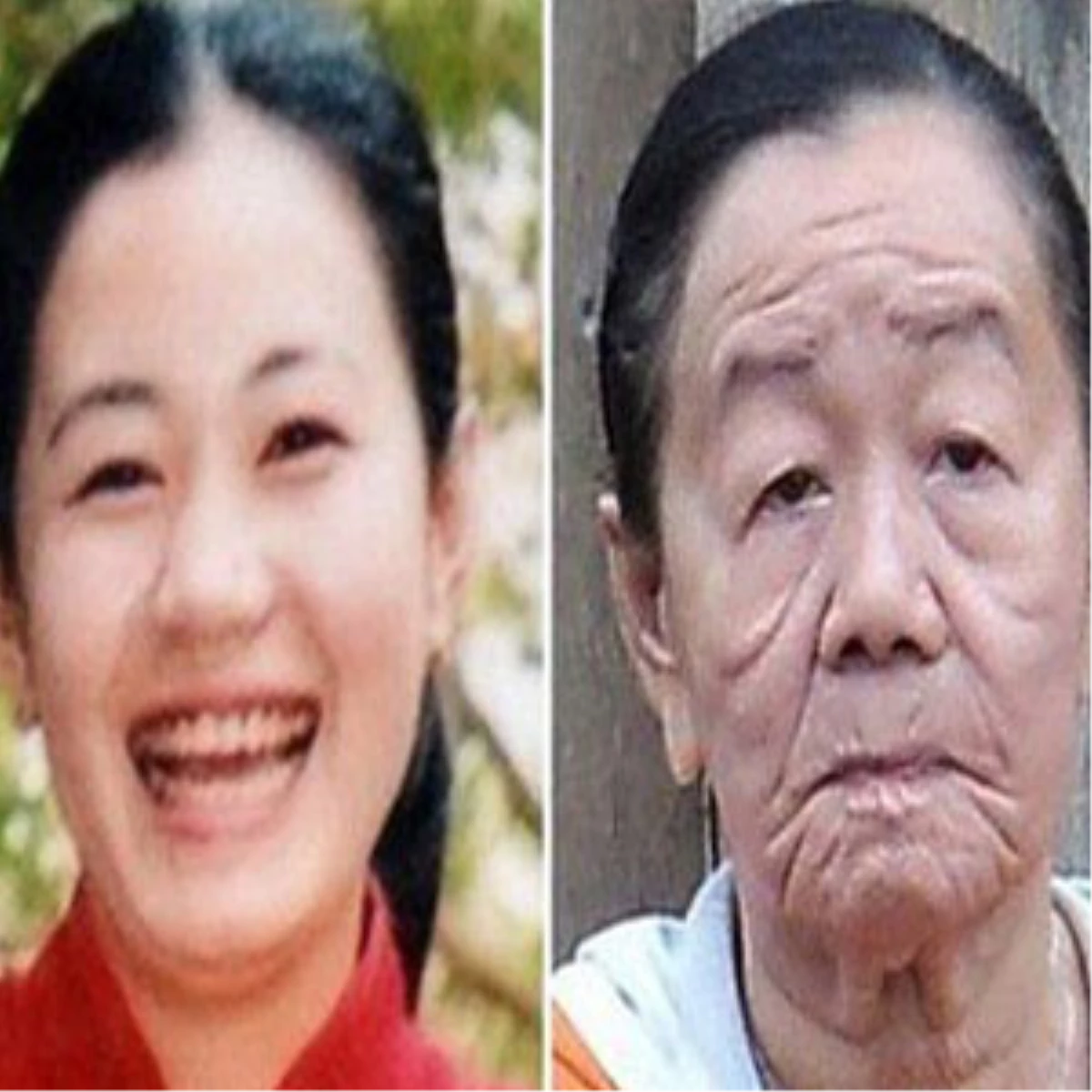 Vietnam\'da Birkaç Gün İçinde 50 Yaş Yaşlanan Kadın
