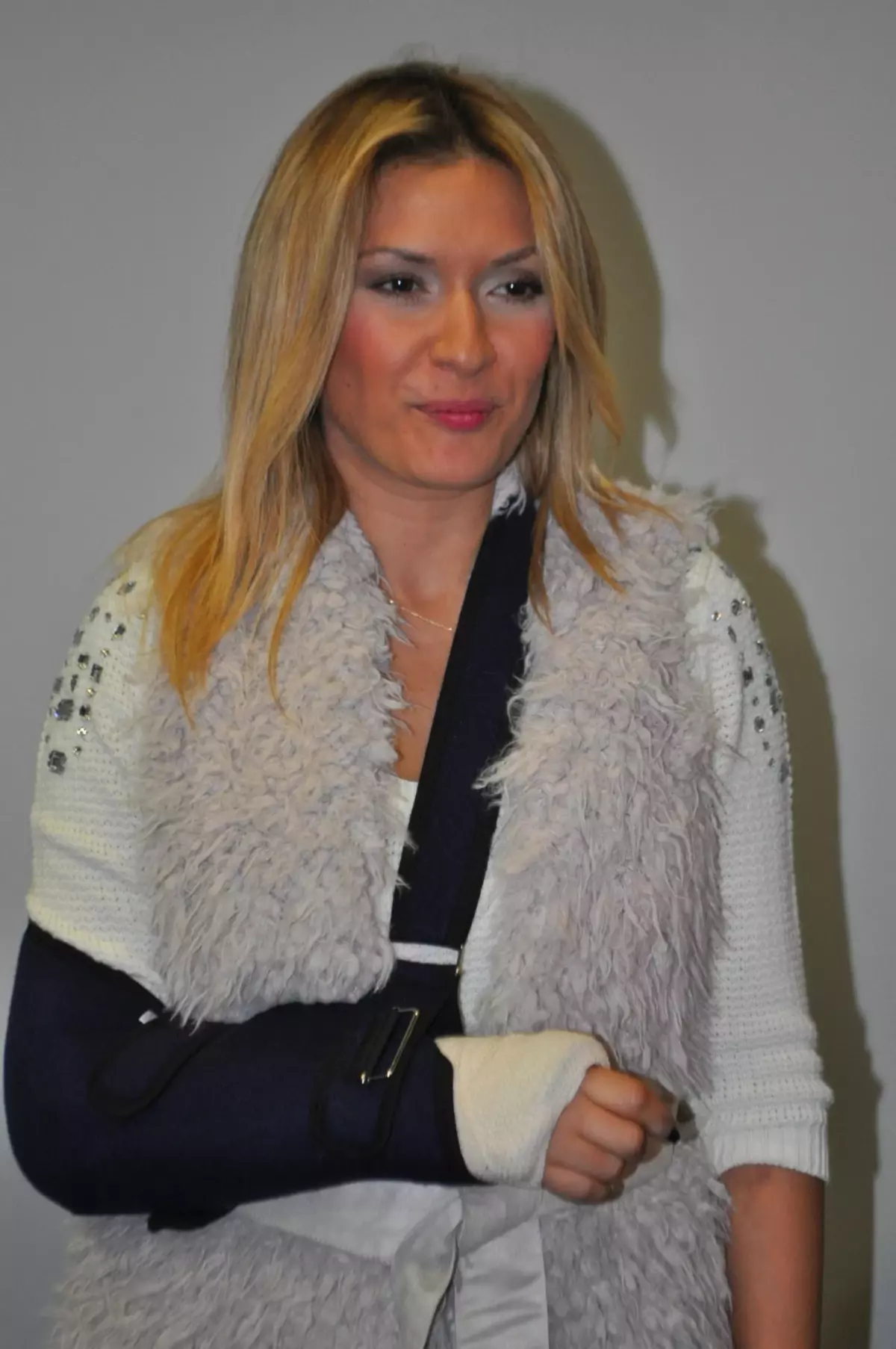 Ünlü Manken Kırık Kolu ile Defileye Çıktı